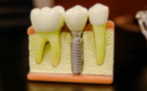 拔牙小学作文合集15篇